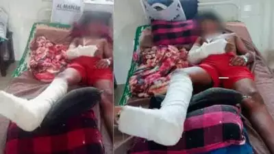 വീ​ട്ടു​മു​റ്റ​ത്ത് ക​ളി​ക്കു​ന്ന​തി​നി​ടെ കാ​ട്ടു​പ​ന്നി​യു​ടെ ആ​ക്ര​മ​ണം; ആ​റാം ക്ലാ​സു​കാ​ര​ന് ഗു​രു​ത​ര പരു​ക്ക്