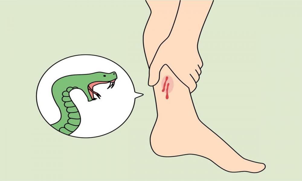 പാമ്പുകടിച്ചാൽ മുറുക്കിക്കെട്ടണോ?: അറിയാം അബദ്ധധാരണകളും സത്യങ്ങളും